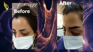 فیلم بدون سانسور کاشت ابروی طبیعی