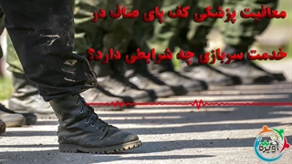 معافیت پزشکی کف پای صاف در خدمت سربازی چه شرایطی دارد؟