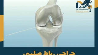 انیمیشن جراحی رباط صلیبی