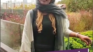 تغییر رنگ دندان