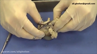 تشریح چشم