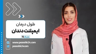 درمان ایمپلنت چقدر طول می کشد؟