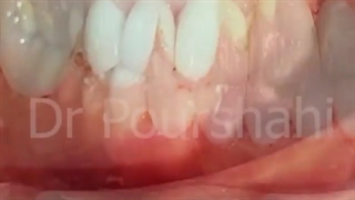آیا شش واحد سرامیک برای هر فرد کفایت می کند؟