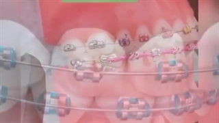 موارد اورژانس در حین درمان ارتودنسی