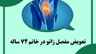 تعویض مفصل زانو در خانم ۷۴ ساله