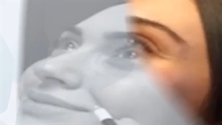 مزونیدلینگ چیست