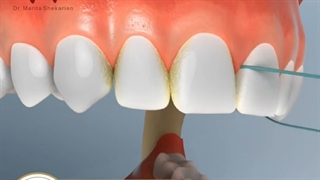 نحوه استفاده از نخ دندان| دکتر ماریتا شکاریان