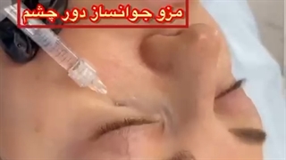 مزو جوانساز