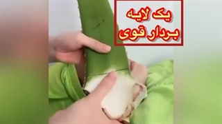 ژل آلوئه ورا