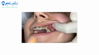 دکتر جهانگیر شیخی فلوشیپ دندانپزشکی زیبایی و لیزر اینسایزینگ