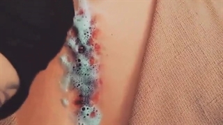 تتو بخیه | 09126130533