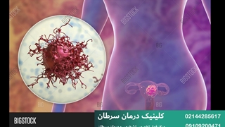 تشخیص سرطان رحم