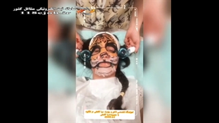 آموزش تخصصی ناخن و پوست سبا کاشفی در لنگرود پروتز دندان