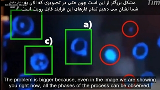 بررسی تصاویر خون افراد واکسن زده