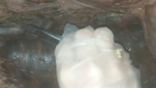 عملی قلب و عروق 14. پزشکی