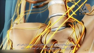 علت درد سیاتیک چیست؟