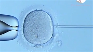 نحوه لقاح IVF