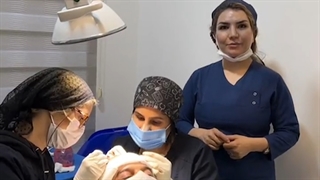 کاشت مو در تهران