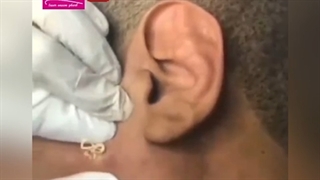 تخلیه جوش 3