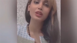 صحبت های زیباجو جراحی شده توسط دکتر حسینی در اهواز