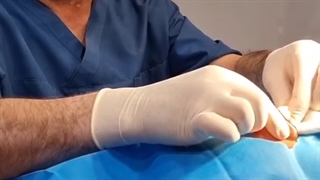 جراحی تیپ پلاستی بینی در اهواز