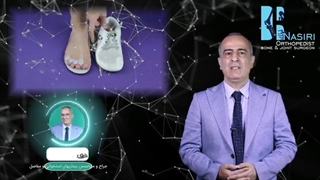 انحراف انگشت شصت پا