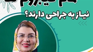 تمام فیبرومها نیاز به جراحی دارند؟