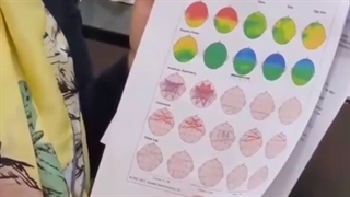 کاربرد نقشه مغزی