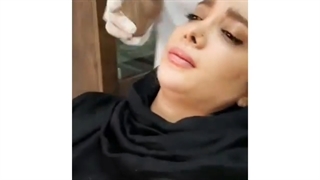 تزریق آنزیم برای رفع مشکل زاویه سازی فک