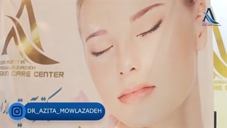 فیلم لیزر موهای زائد در مطب دکتر آزیتا مولازاده