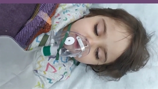 دندانپزشکی با بیهوشی کودک