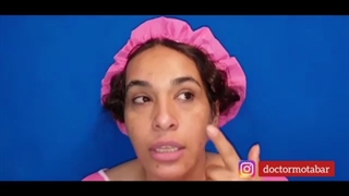 فیلم واقعی لیفت صورت و تزریق چربی به صورت