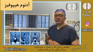 عمل جراحی اندوسکوپی ادنوم هیپوفیز - آکرومگالی