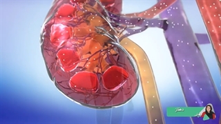 دیالیز کلیه