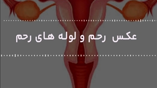 عکس رحم و لوله رحم