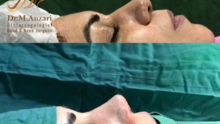 فیلم واقعی جراحی بینی از نزدیک