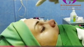 جراحی زیبایی بینی