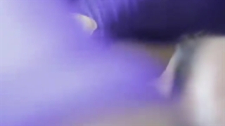 کرم دور چشم صمیم سفارش باشماره09023115040