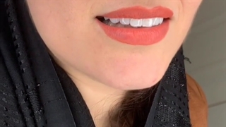 لمینت سرامیکی ایمکس