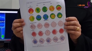 درمان با نوروفیدبک