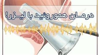 درمان هموروئید با لیزر پروتز دندان