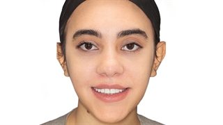 ارتودنسی و اصلاح طرح لبخند | دکتر داودیان