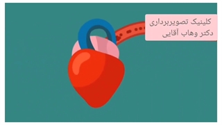 فشار خون چیست؟