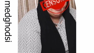 تصاویر قبل و بعد از عمل اسلیو معده