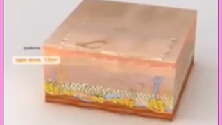 مراقبت های بعد از هایفوتراپی