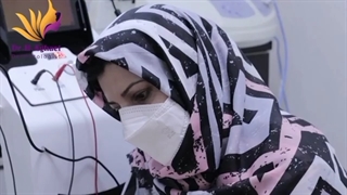 جوانسازی صورت با اندو آر اف