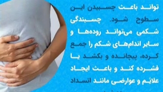 چسبندگی شکم