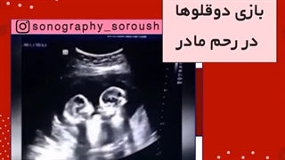 فیلم بازی دوقلوها در رحم مادر