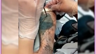 بهترین روش سریع پاک کردن تاتو ابرو و بدن