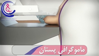 ماموگرافی پستان